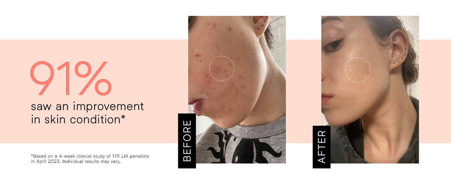 Electric High-Frequency Therapy Device – Wireless High Wave Electrotherapy Rod (1 Set)