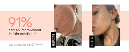 Electric High-Frequency Therapy Device – Wireless High Wave Electrotherapy Rod (1 Set)