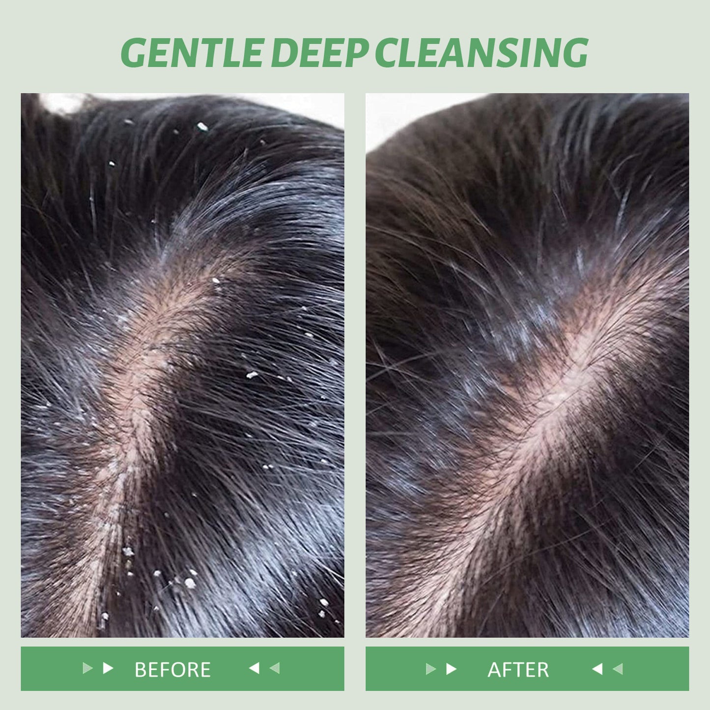 Rosemary Hair Scrub – Deep Moisturizing & Scalp Renewal