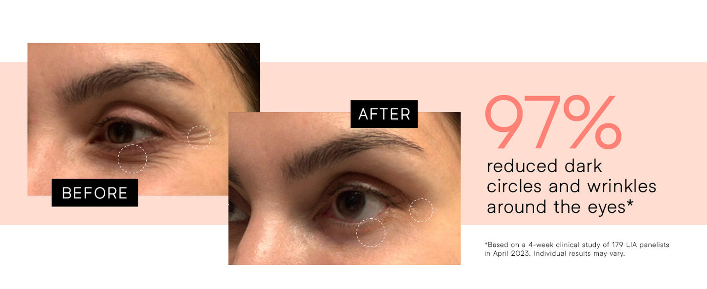 Electric High-Frequency Therapy Device – Wireless High Wave Electrotherapy Rod (1 Set)