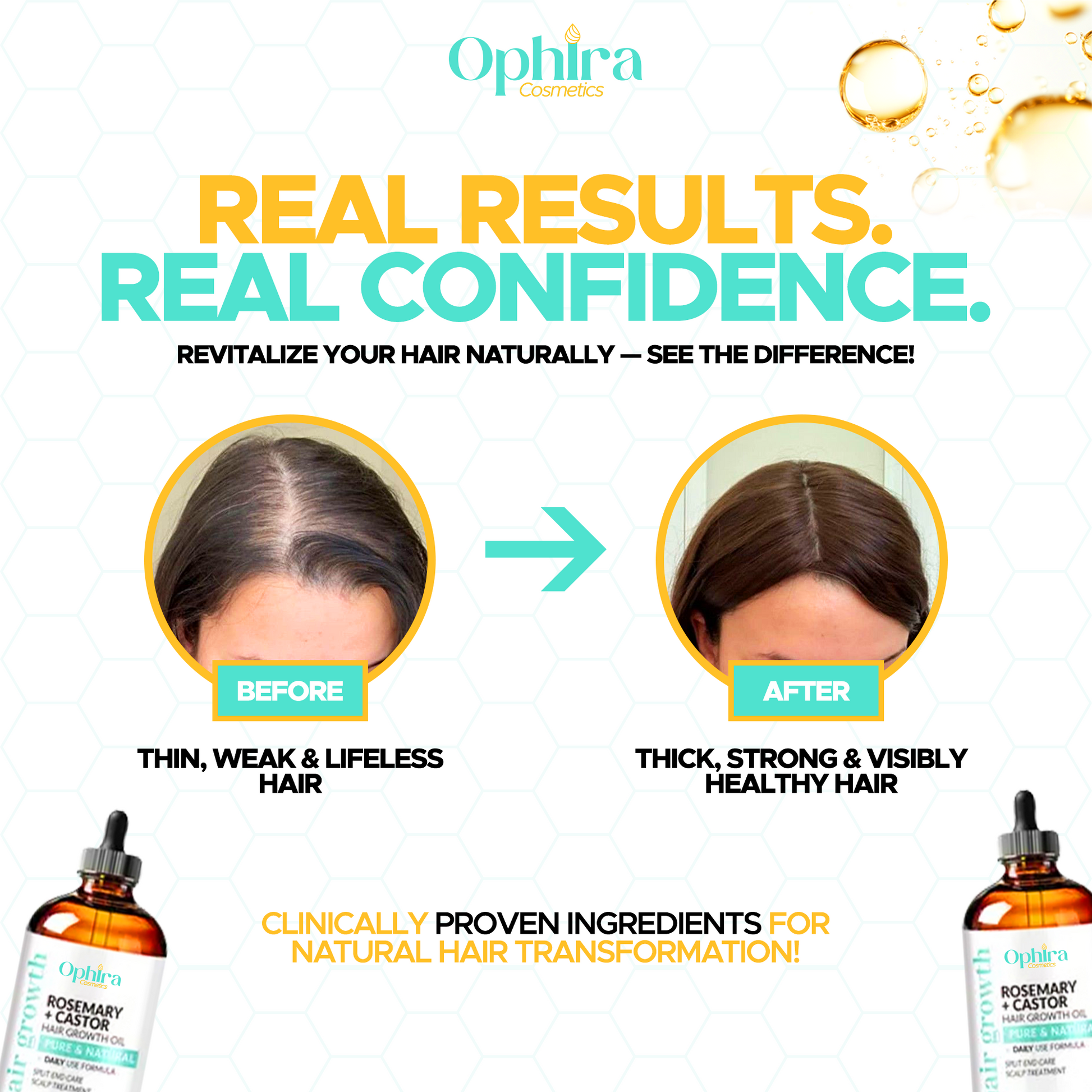 Ophira Cosmetics™ – Hair Growth Oil & Anti-Loss Treatment (118ml) + Scalp Massage Brush