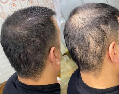 Rosemary & Castor Hair Growth Oil & Anti-Loss Treatment (118ml) + Scalp Massage Brush - Ophira Cosmetics™